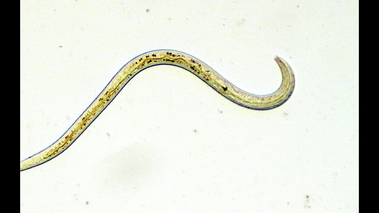 Descubre el fascinante ciclo de vida de los nematodos