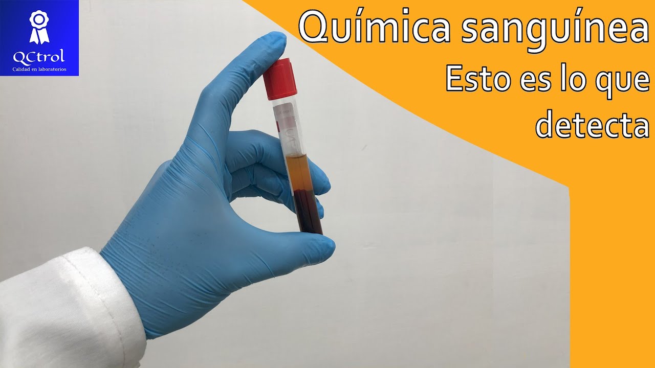 Diferencias clave entre químicas sanguíneas de 27 y 35 elementos